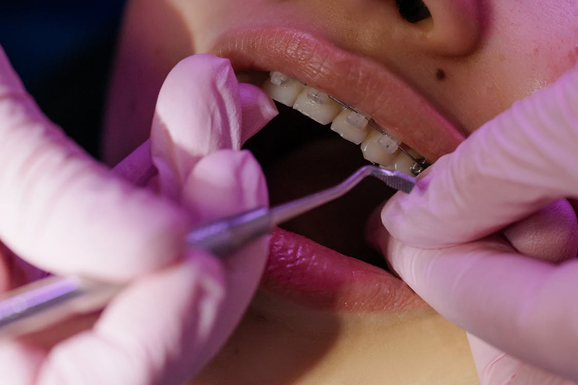 Effective Strategies for Preventing Periodontal Problems